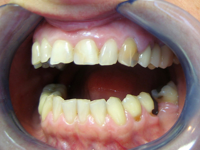 Bez�r�shoz kattintson a k�pre!