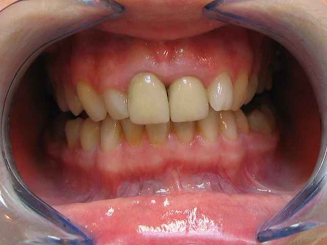 Bez�r�shoz kattintson a k�pre!