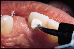 bels� fogfeh�r�t�s1