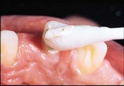 bels� fogfeh�r�t�s2