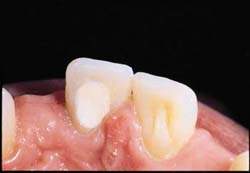 bels� feh�r�t�s3